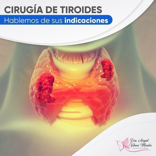 Avigail Soveida Velasco Morales-8