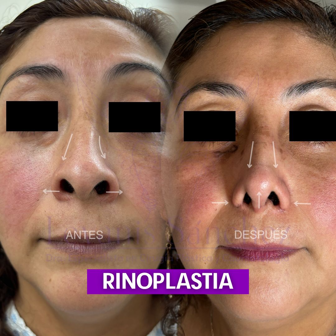 Leyanis Sánchez Hidalgo-7