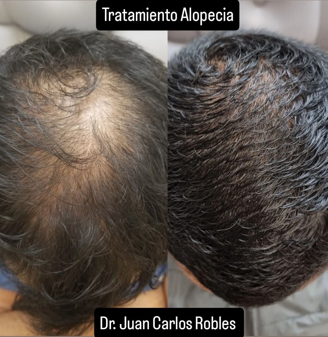 Juan Carlos Robles Méndez-18