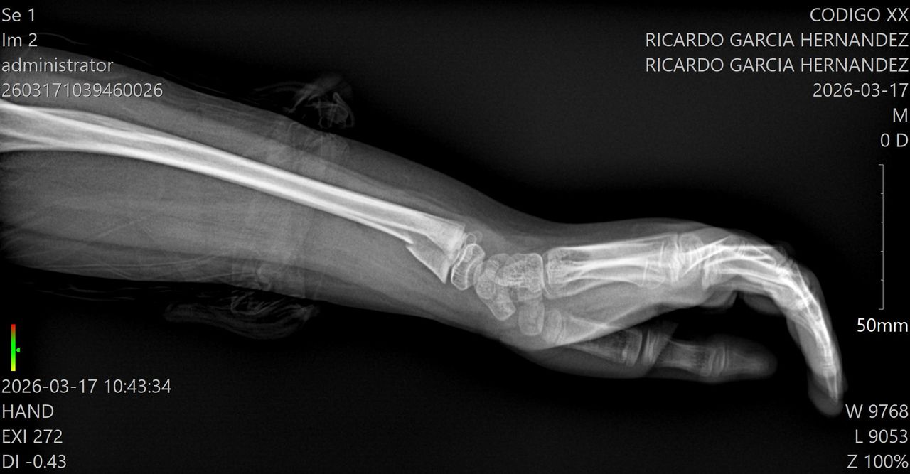 Alejandro Irisson-15