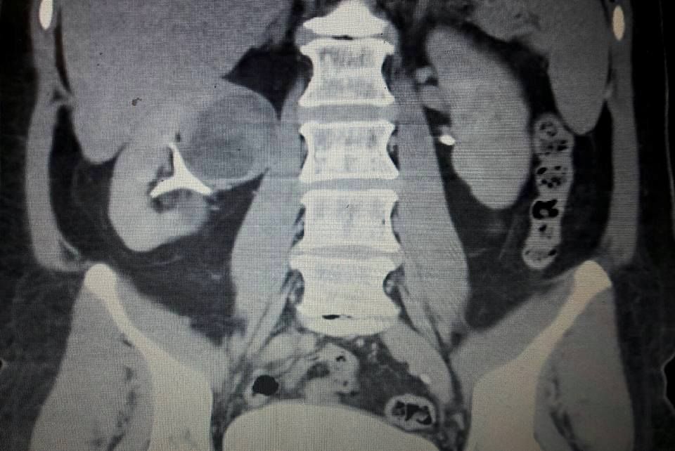 Héctor Iván Martínez López-24