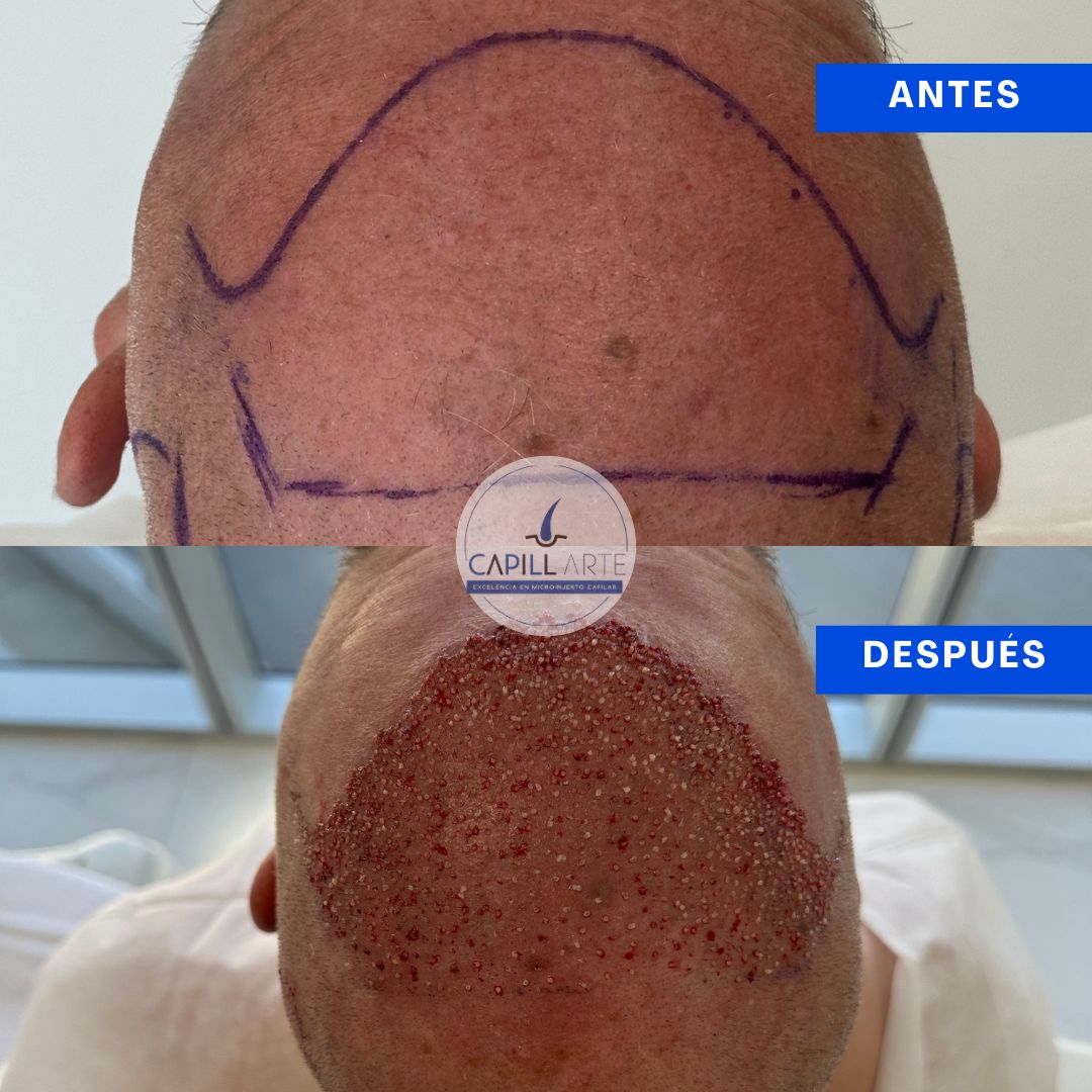 Adrian Hernandez Lopez-29