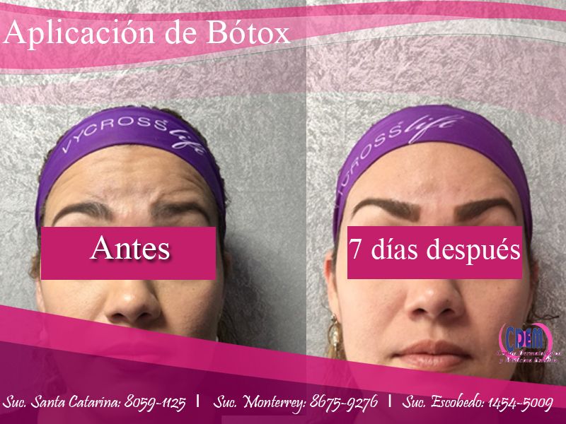 Mercedes Fernández Reyes-15