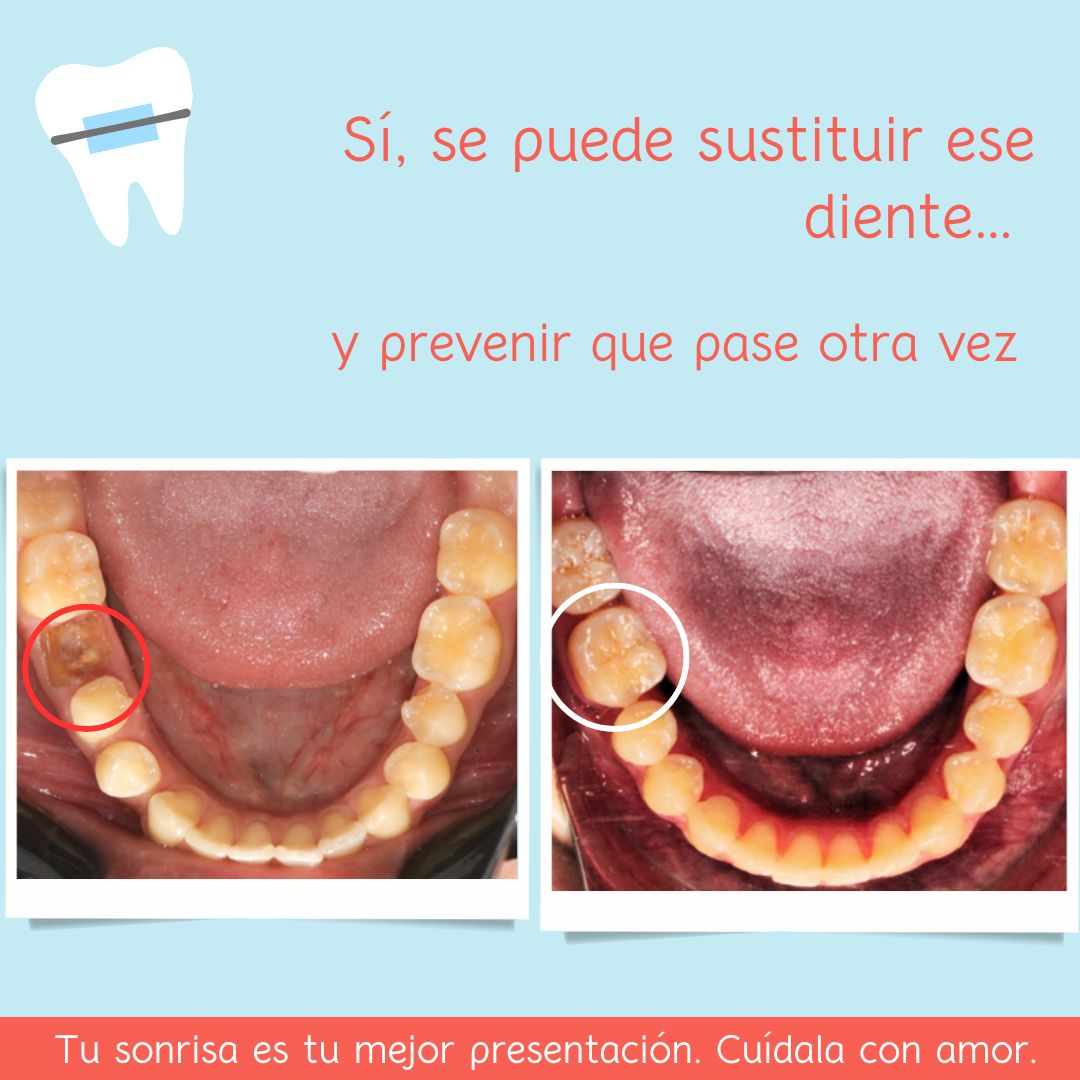 Nora Gabriela Loranca Moscosa-2