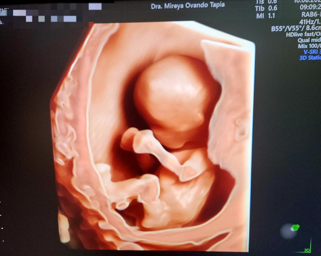 Mireya Ovando Tapia-4