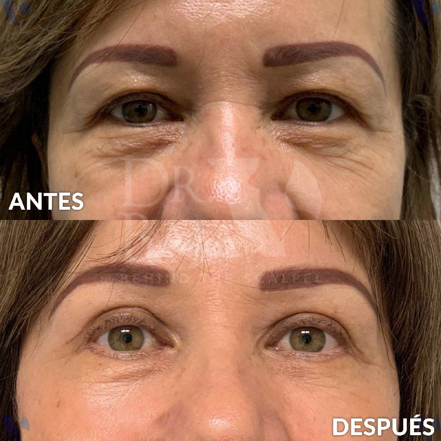 Renato Rodríguez Hirales-9