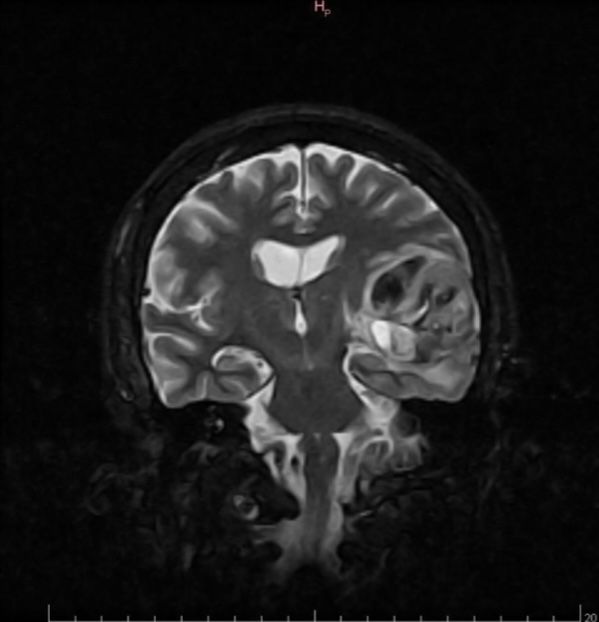 Celia Teresa De Jesús Álvarez Gamiño-13