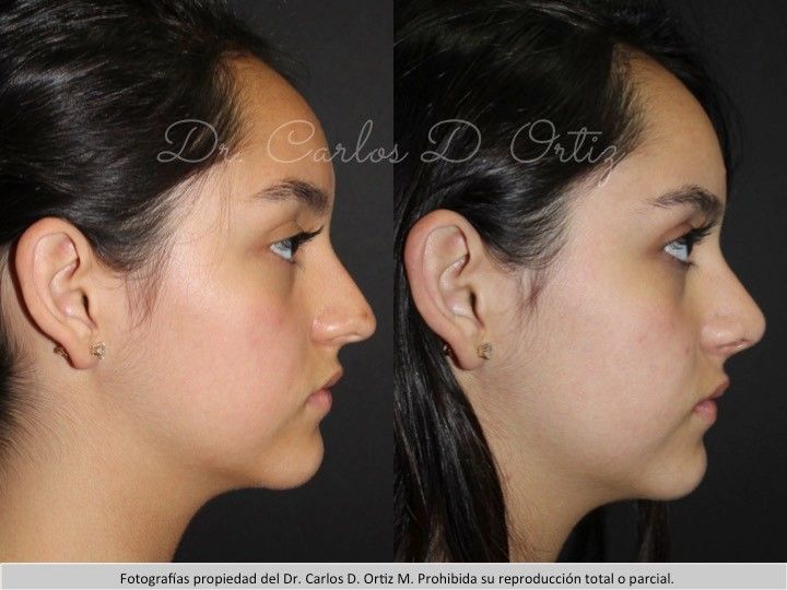 Carlos David Ortiz Moreno-50