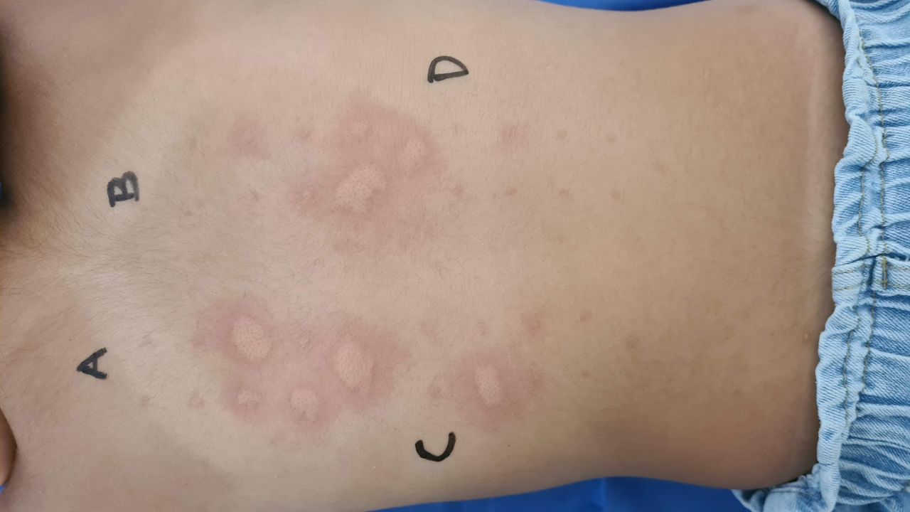 Diego Adrián Reyes Méndez-8