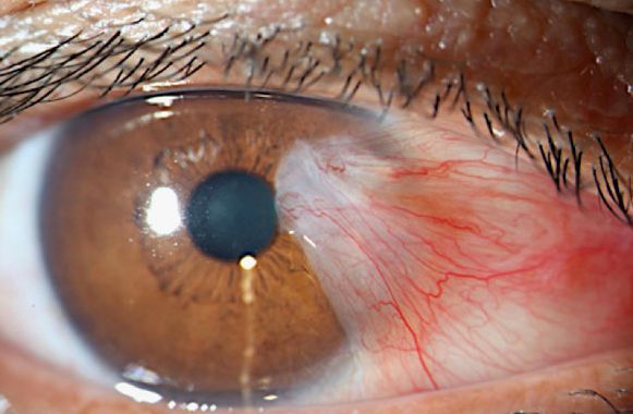 Alain Matabuena D.-6