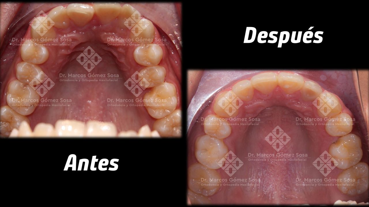 Marcos Gómez Sosa-16