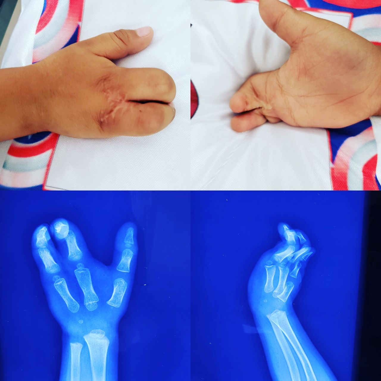 Alfonso Meza Vernis-66