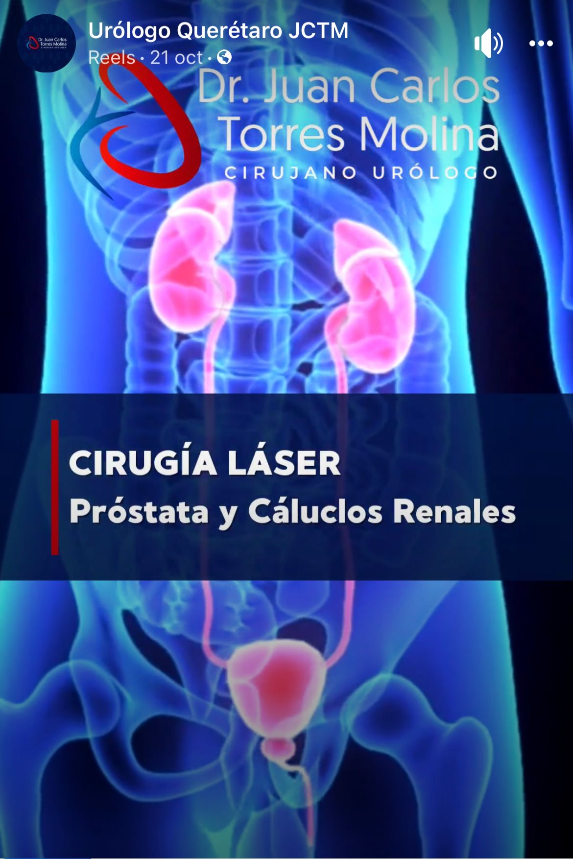 Juan Carlos Torres Molina-3