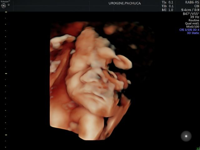 Rafael Medina Vargas-4