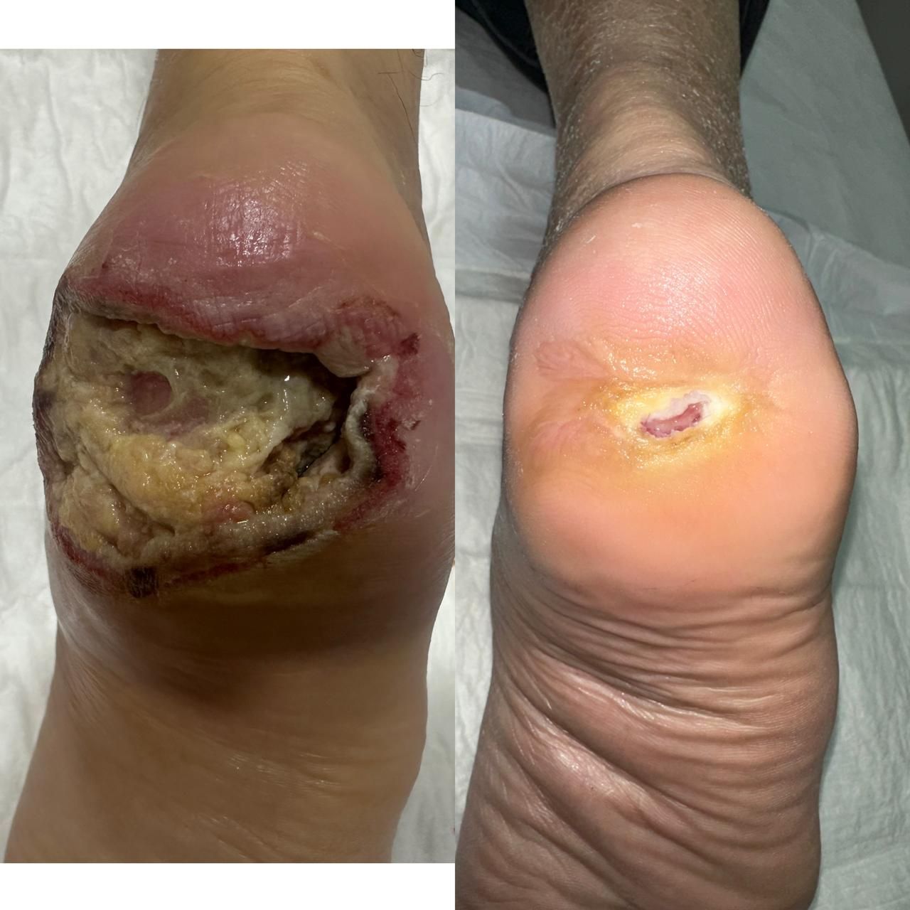 Jhonatan López González-56