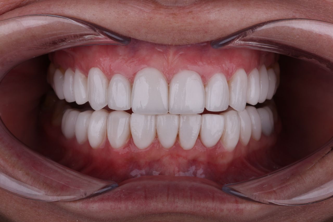 Daniel Perez Parcero-6