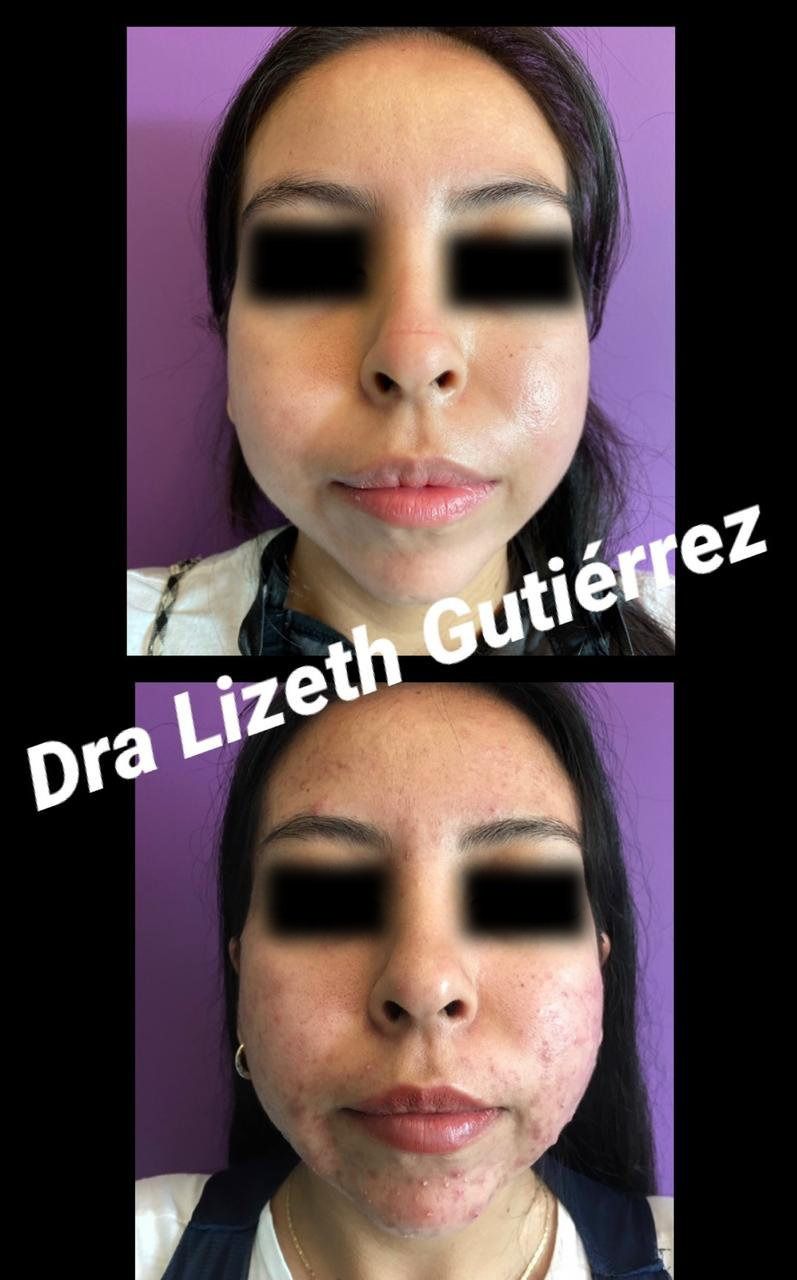 Lizeth Alejandra Gutiérrez Chavéz-16