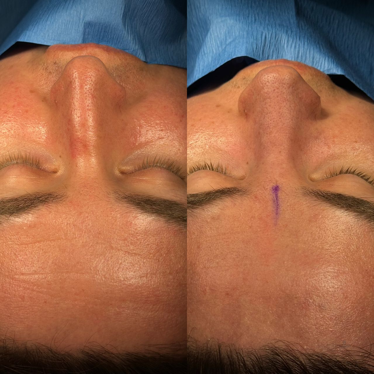 Angel Castro Urquizo-28