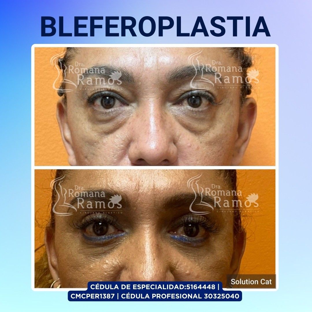 Romana Ramos Cárdenas-6