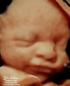 Eduardo Noé Nava Guerrero-5