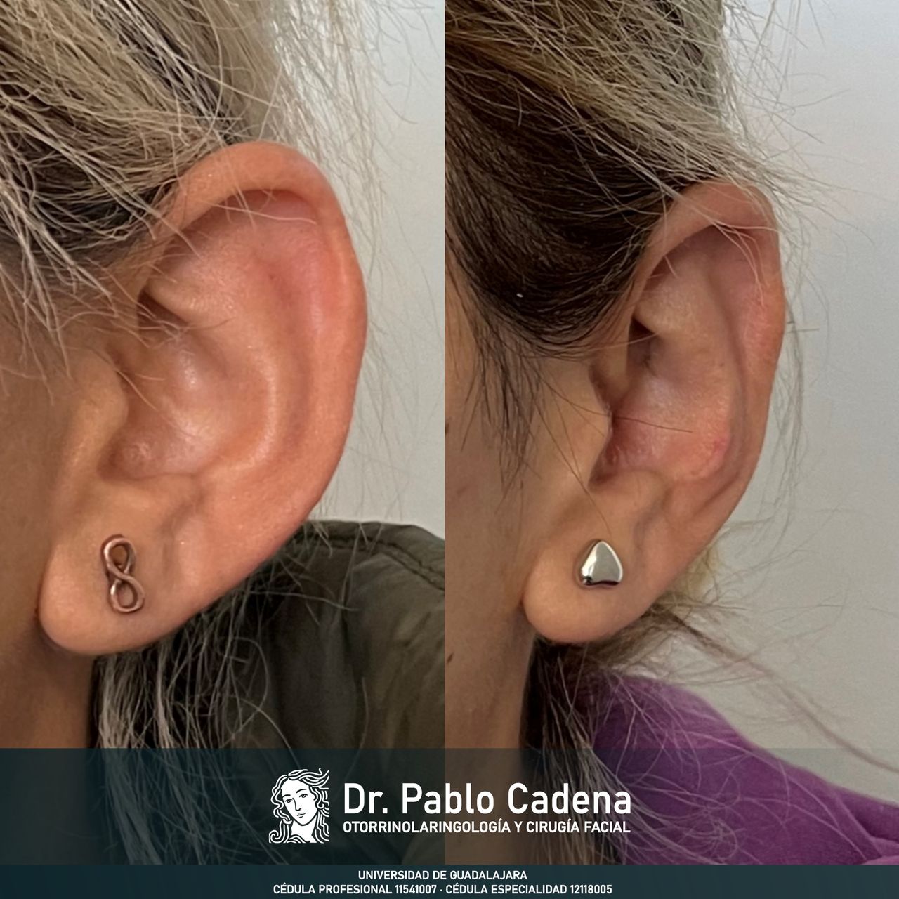 Juan Pablo Cadena Calderón-16