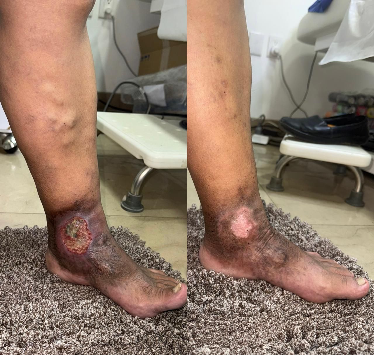 Jhonatan López González-78