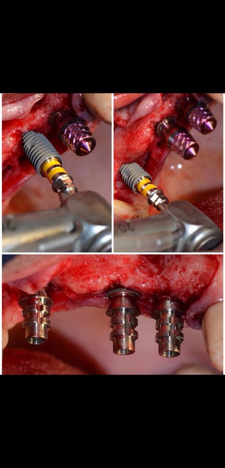 Carlos Ernesto Contreras Castellanos-21