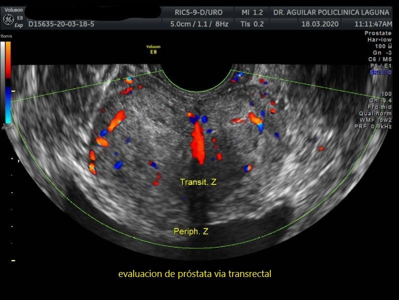 Edgar Fernando Aguilar Morales-4