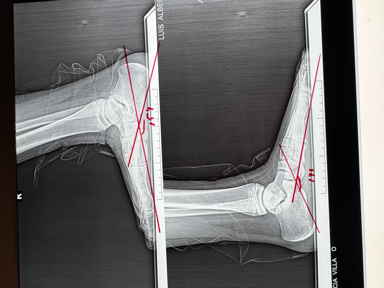 Luis Fernando Cortés Torres-2