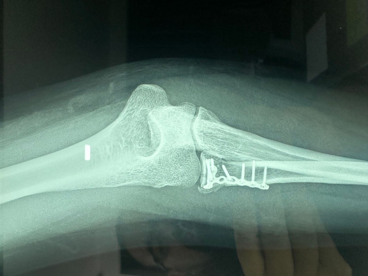 Carlos Ignacio Muñoz Valadez-42