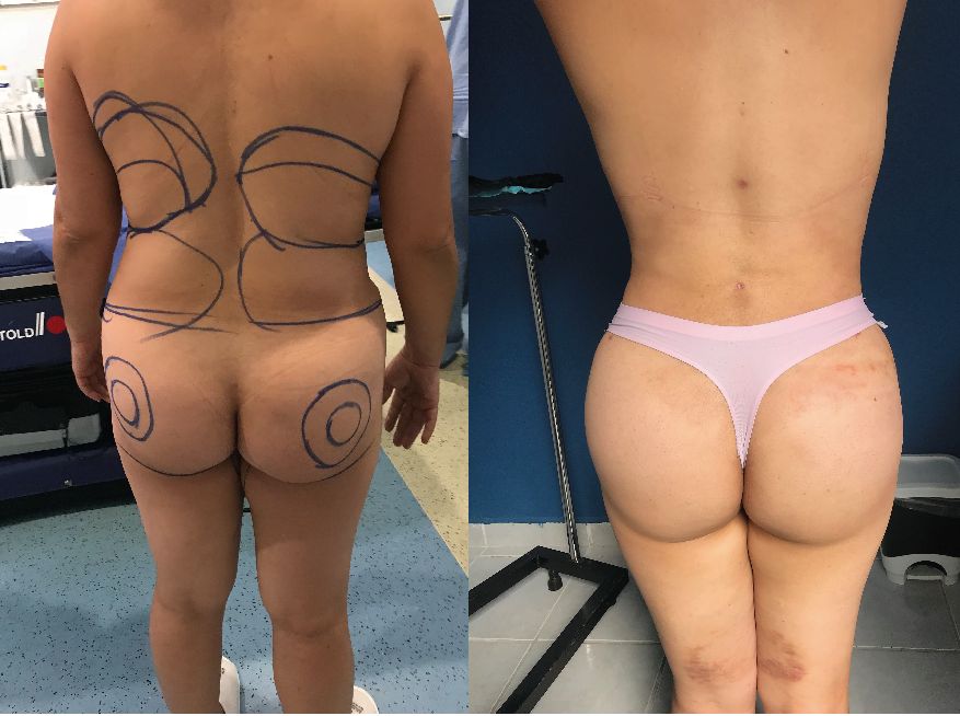 J. Antonio Meré Gómez-10