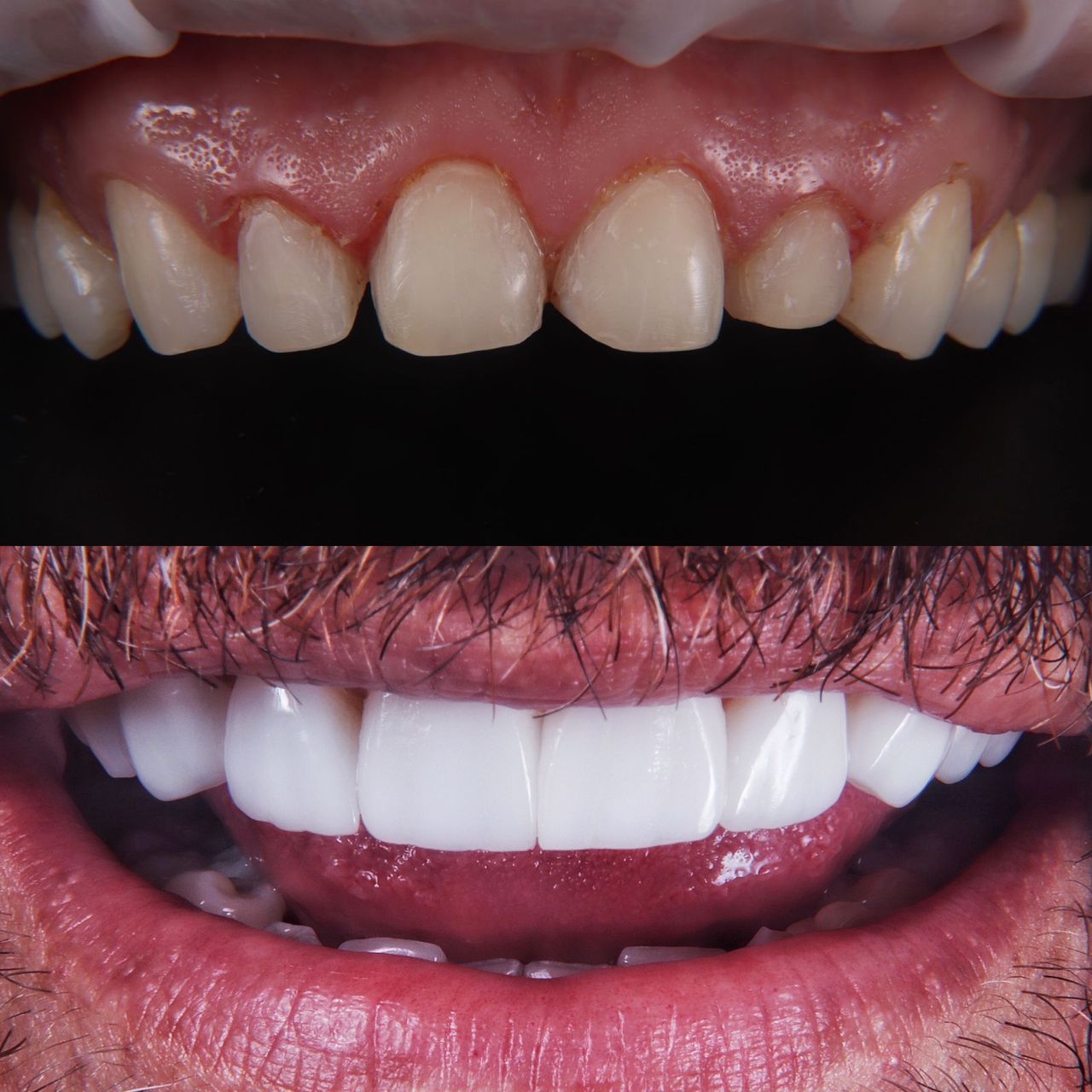 Juan Diego Lopez Ramirez-13