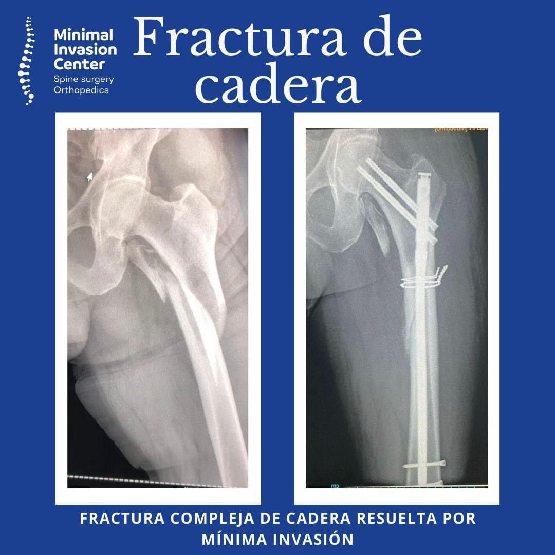 Omar Marroquín Herrera-22