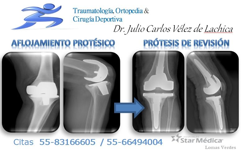 Julio Carlos Vélez De Lachica-15