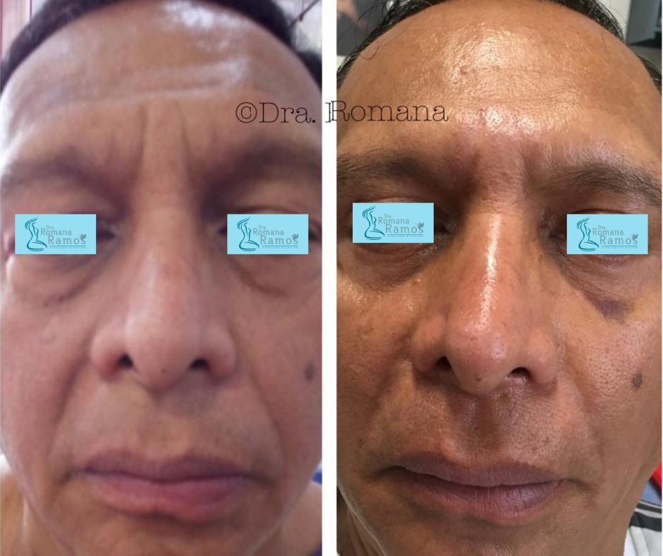 Romana Ramos Cárdenas-48