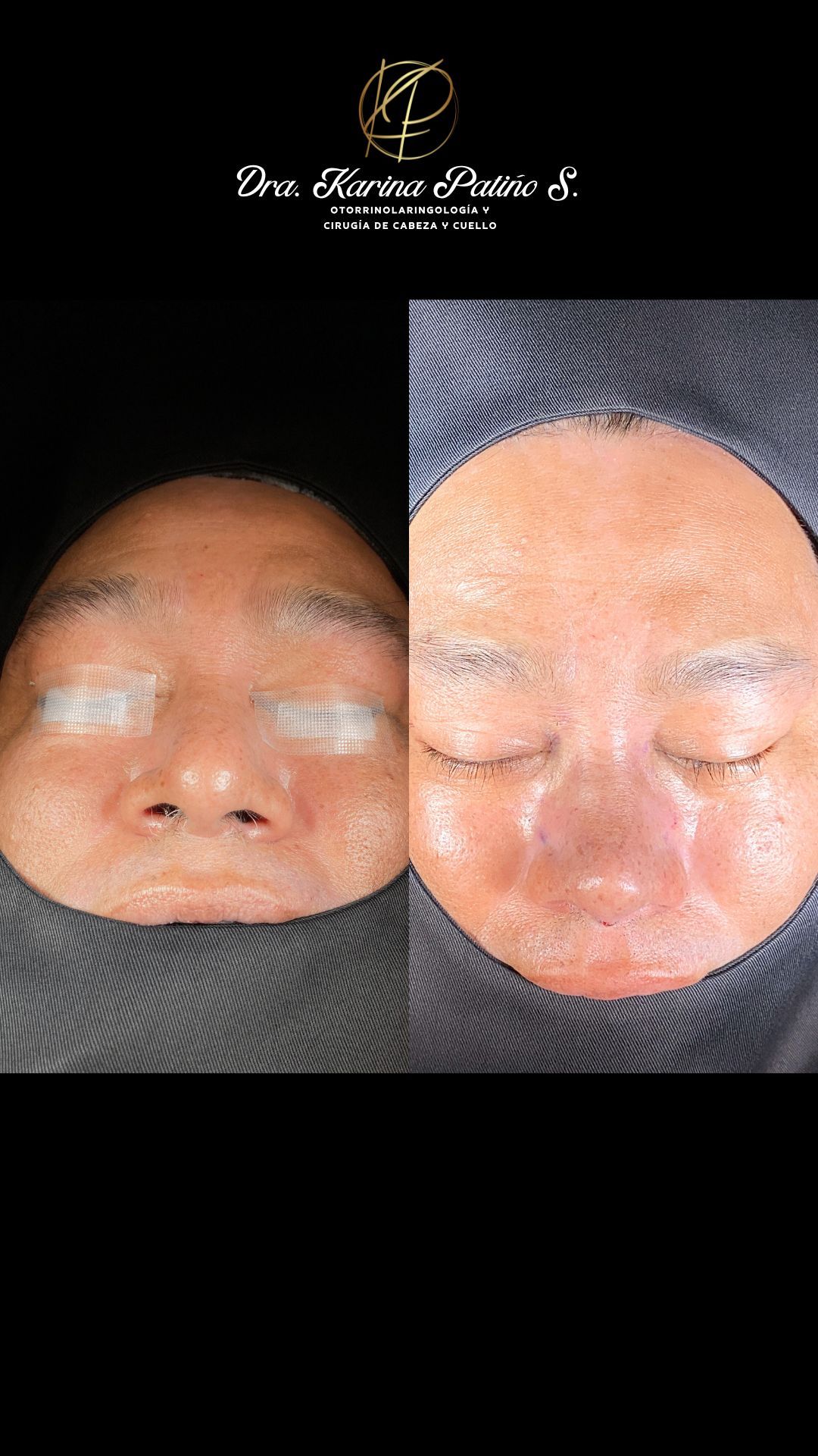 Karina Patiño S.-17