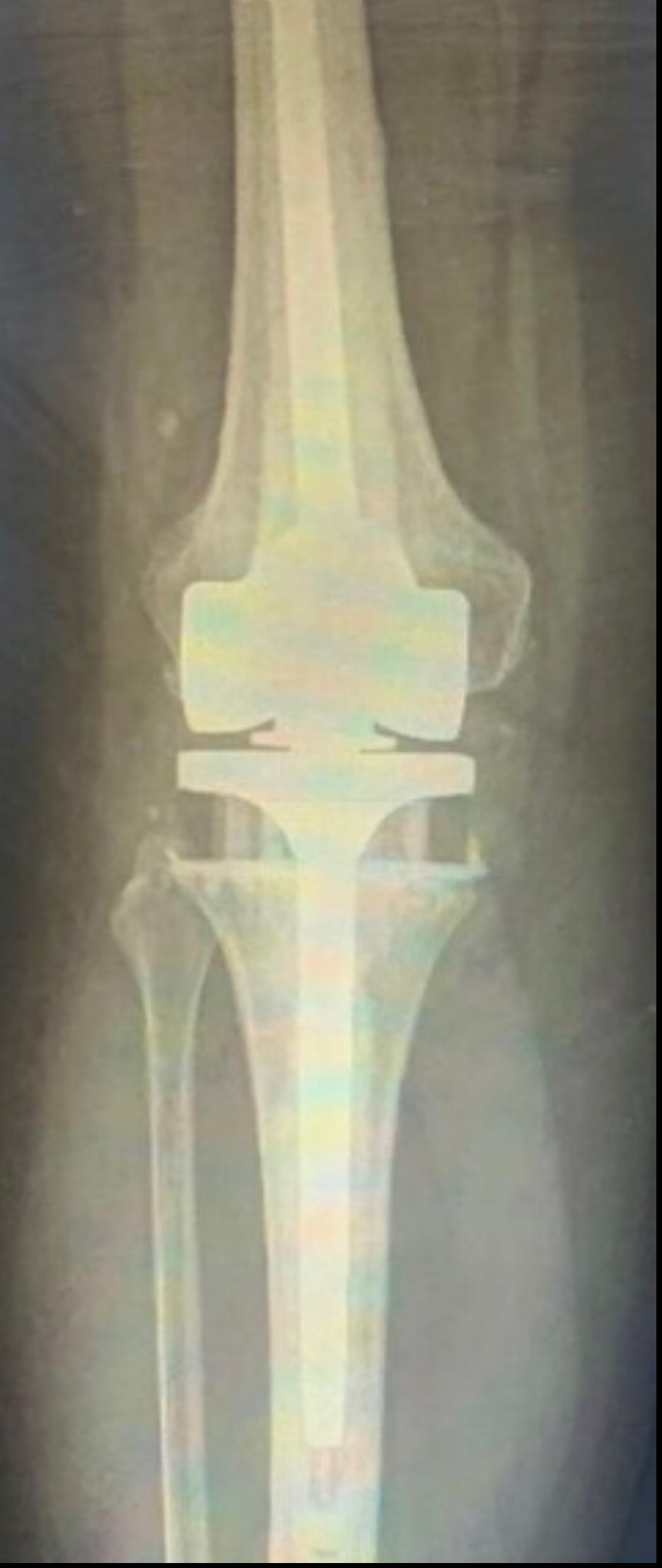 Alejandro Parés Rubí-0