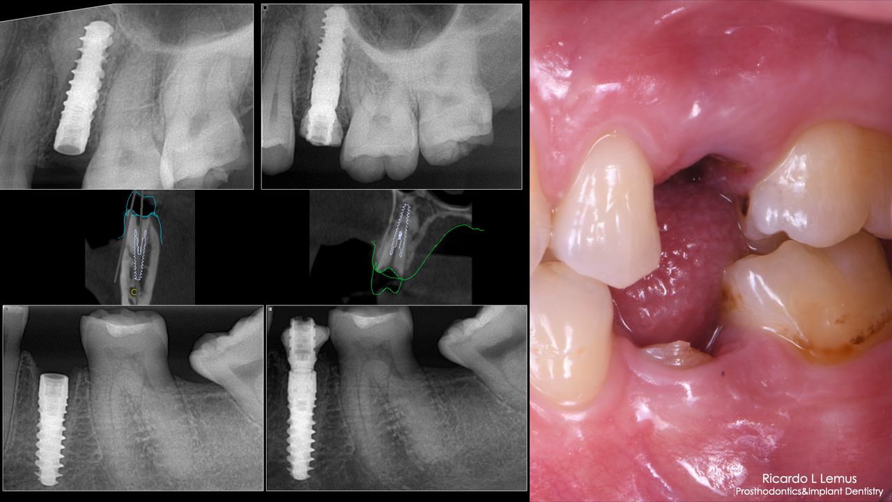 Ricardo López Lemus-128