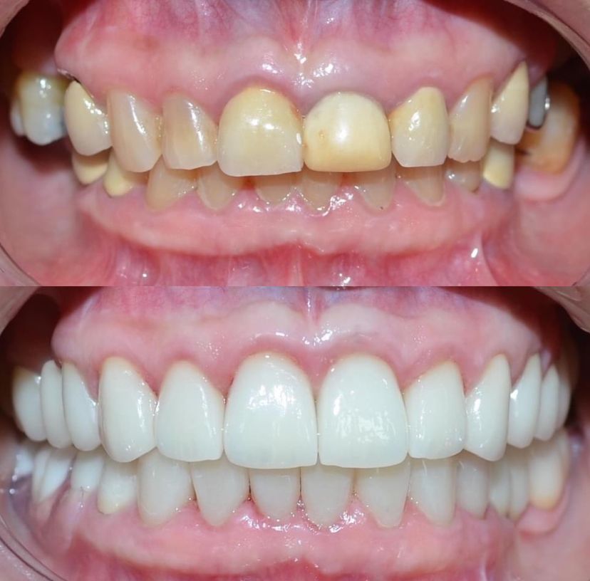 Mari Carmen Platas Canales-1