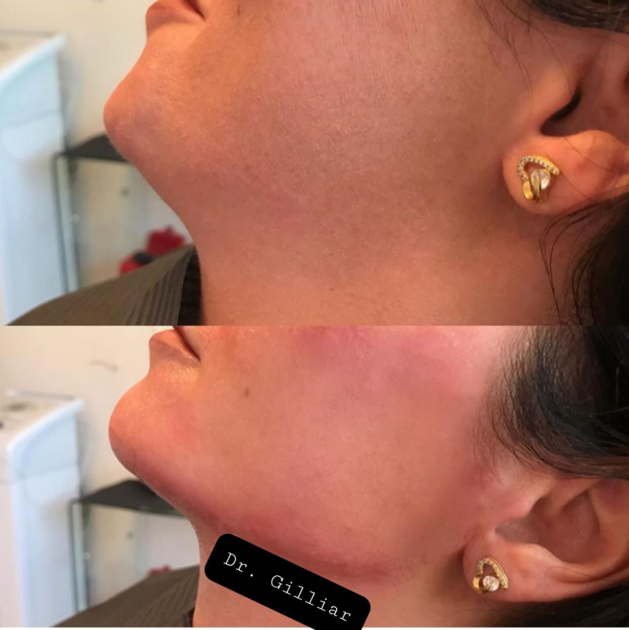 Gilliar Emmanuel Eudave De Lima-17