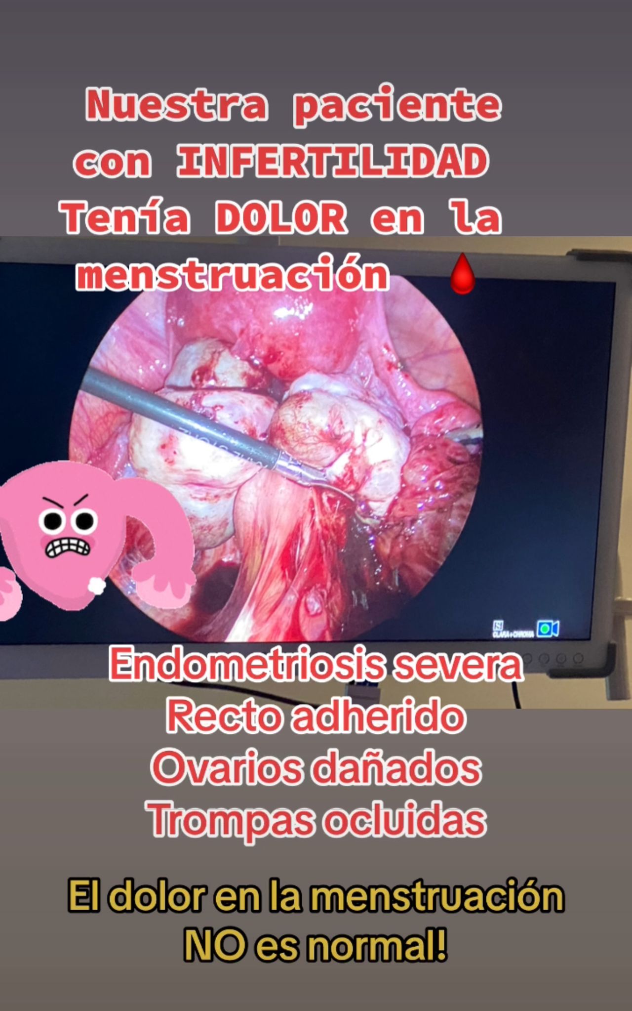 Griselda Reyes Torres-64