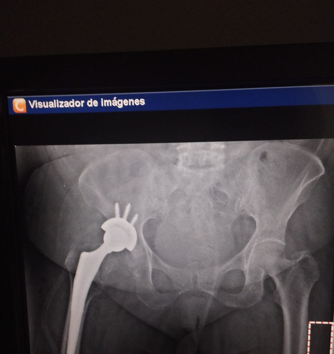 Max Georges Sainte Bernal-14