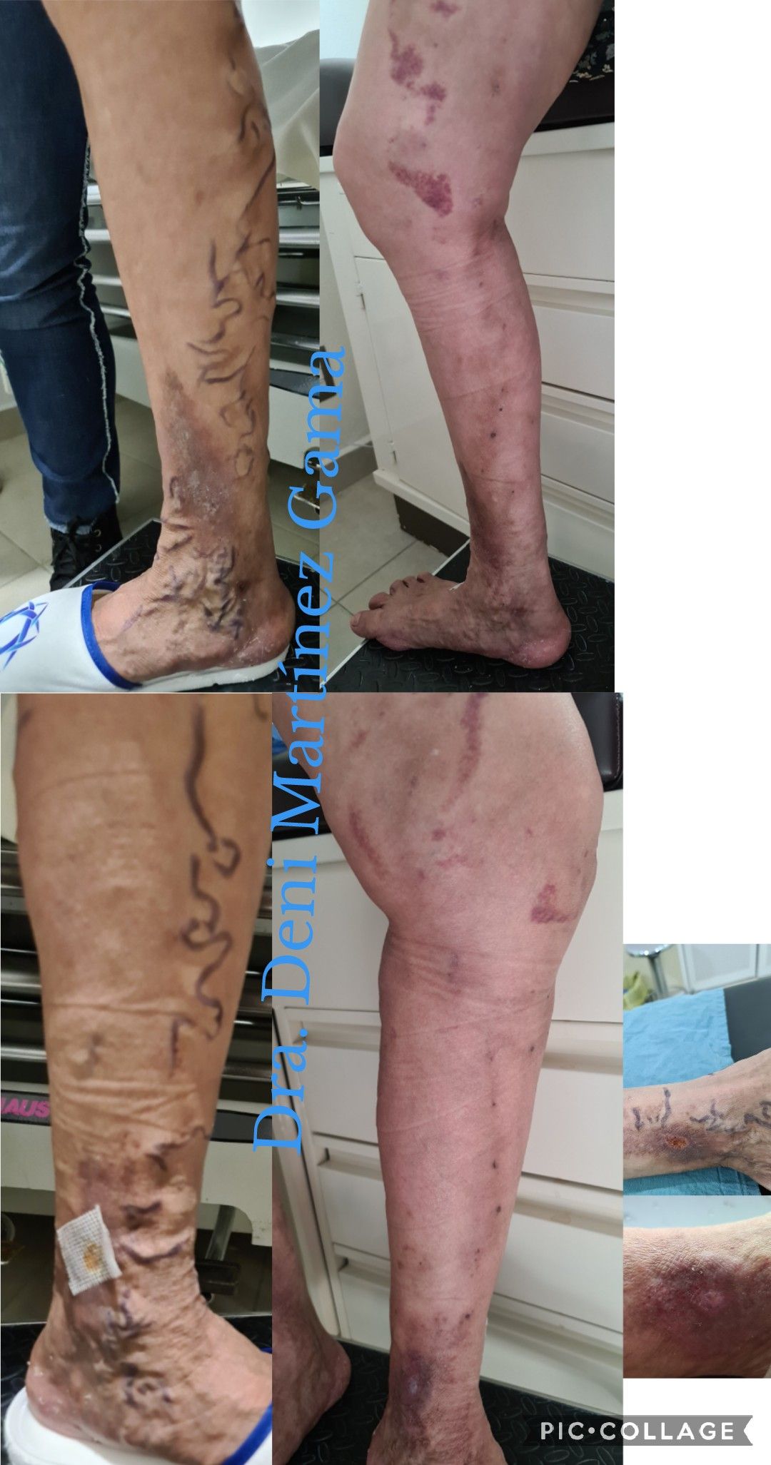 Deni Martínez Gama-12