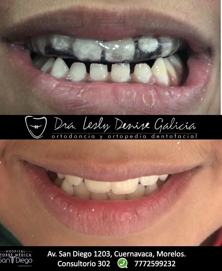 Lesly Denise Galicia Borjas-2