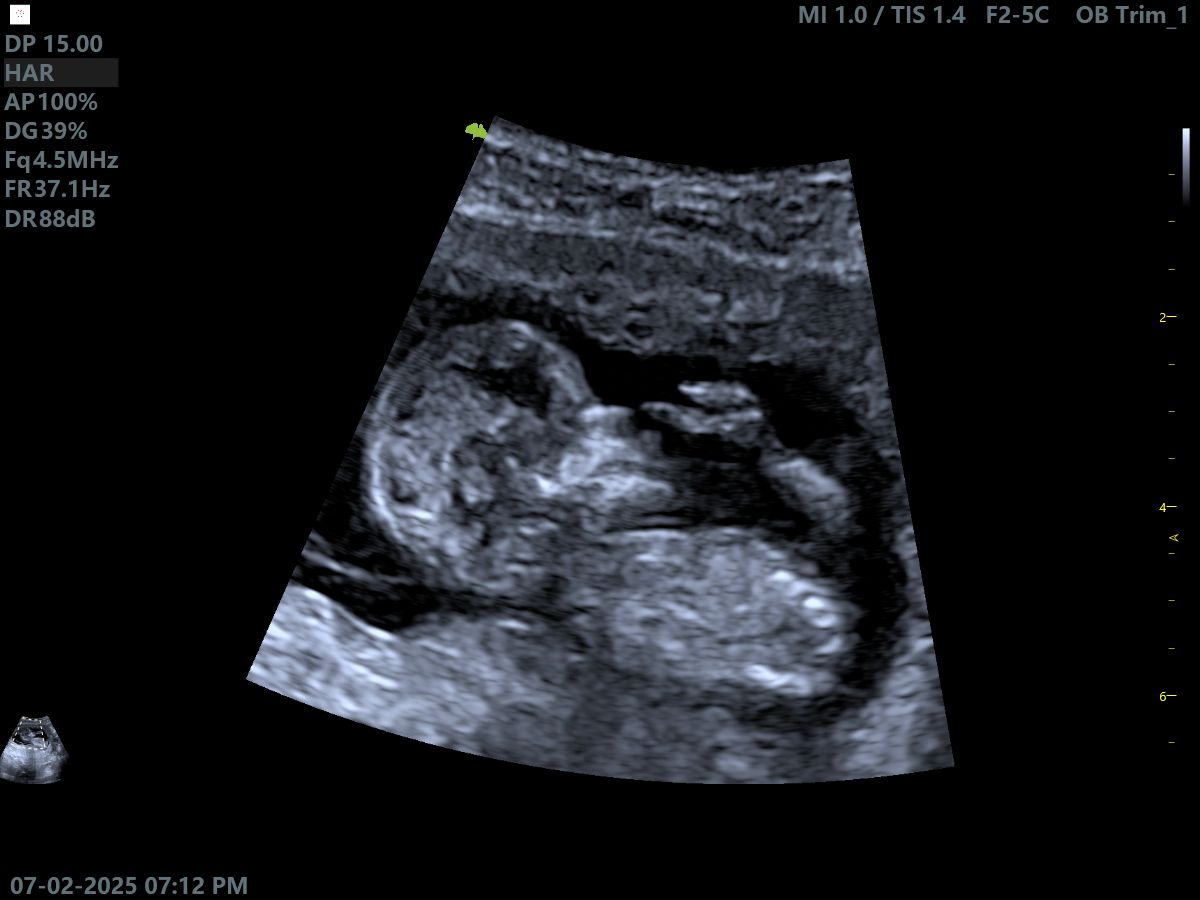 Albert Amaya Flores-1