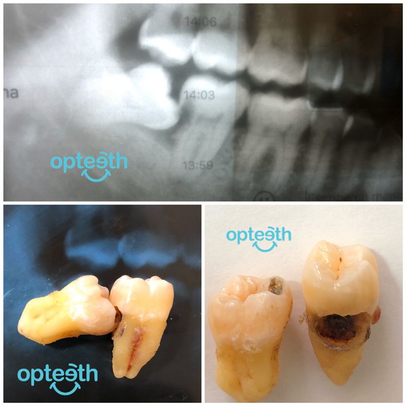 Zuriel Ayala Garcia-13