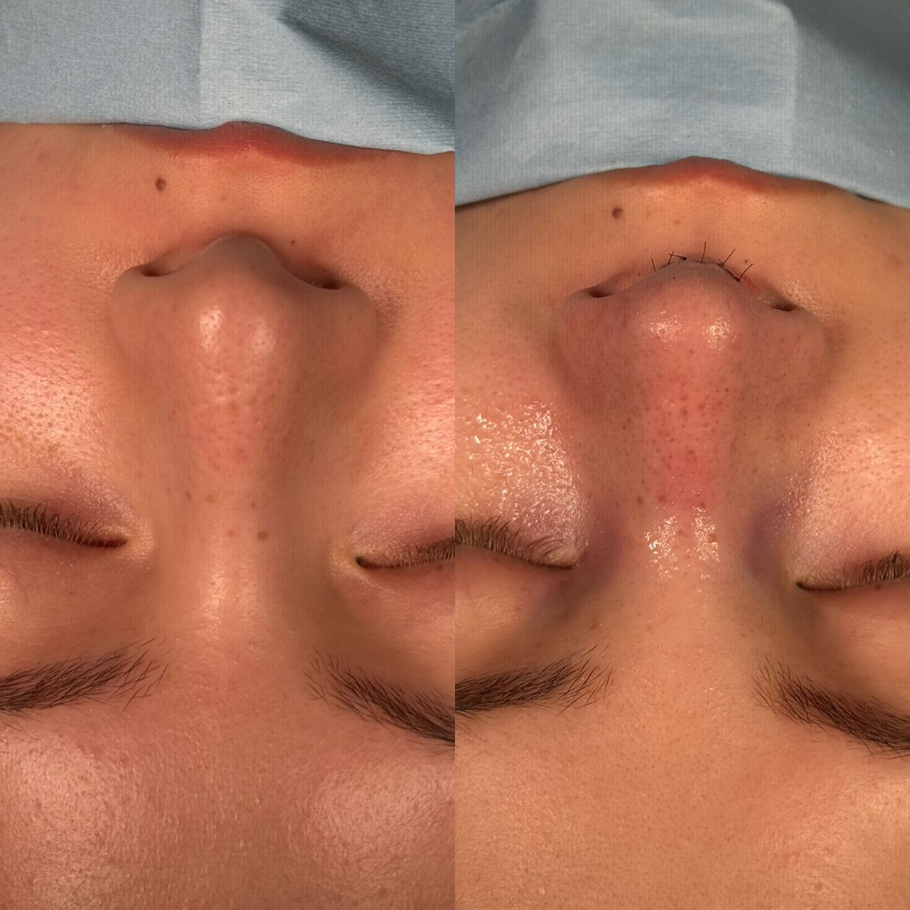 Angel Castro Urquizo-140