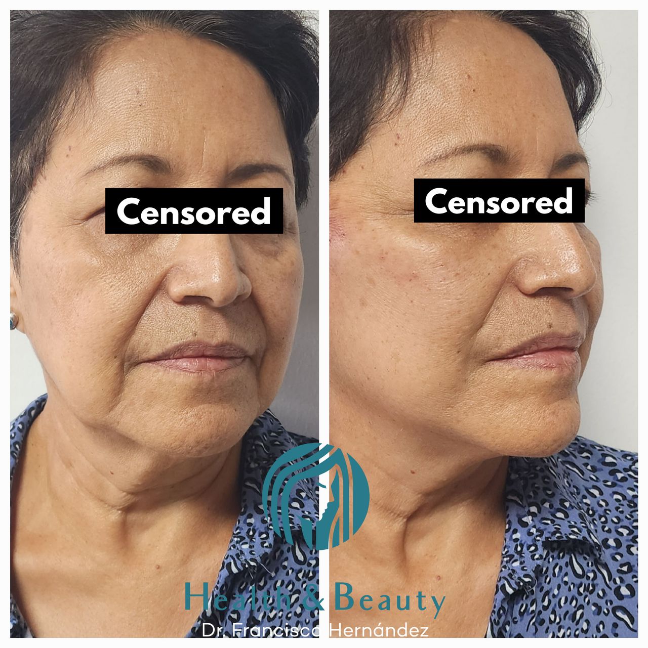 Francisco Hernández Gómez Crespo-8