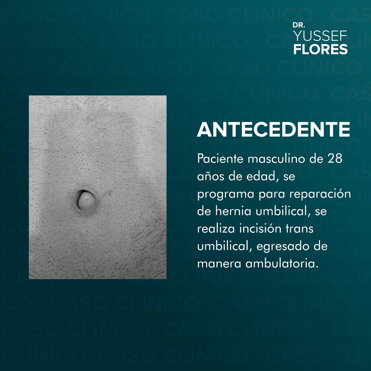 Yussef Flores López-50