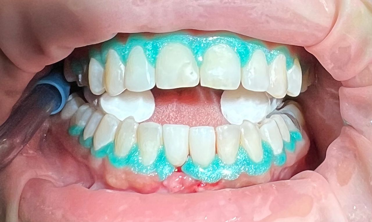 Oswaldo Sanchez Gonzalez-6